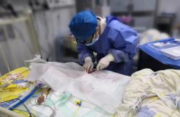 梧州市工人医院采用血浆置换救回“毒鼠强”中毒患儿